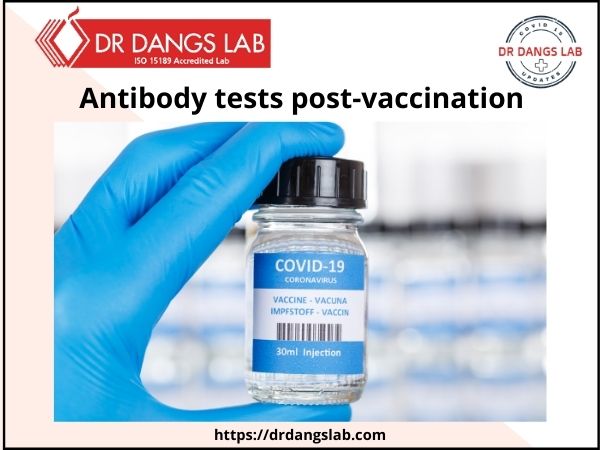 antibody-test-post-covid-vaccination